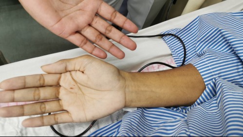 Estas son las señales que te ayudarán a saber si tienes anemia