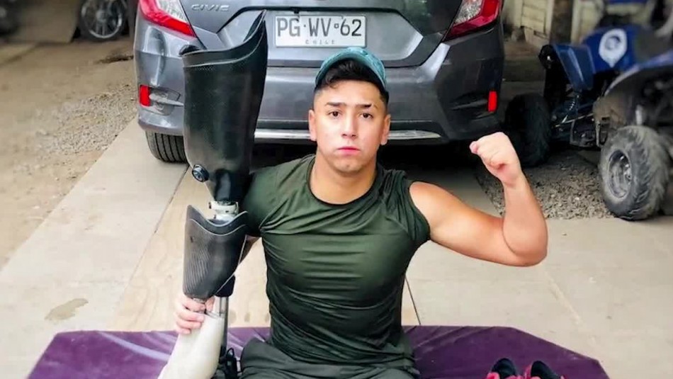 Jugador de fútbol perdió sus dos piernas tras ser atropellado: La conmovedora historia de Santiago Poblete