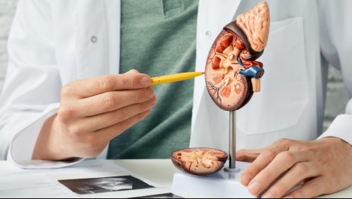 Así es como puedes detectar que sufres de una insuficiencia renal