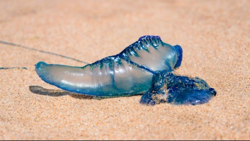 Así se siente la picadura de fragata portuguesa