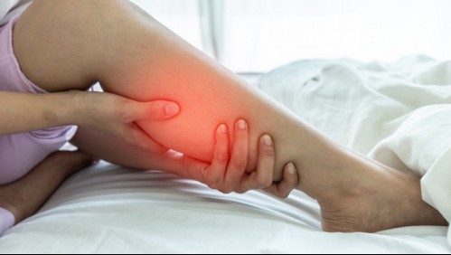 ¿Te duele una pierna?: Estos son los síntomas de una trombosis venosa profunda