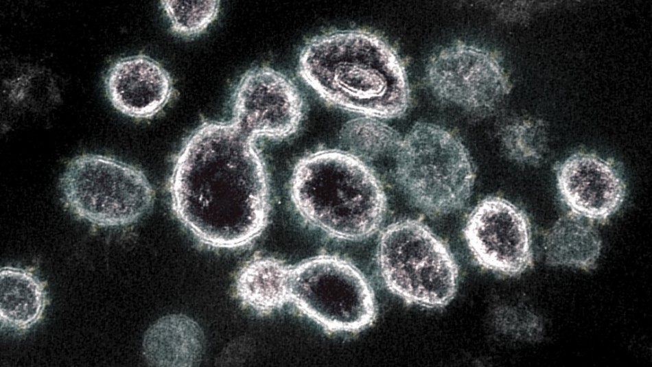 Epidemiólogo prevé peak por variante Ómicron al finalizar enero: Baja mortalidad y cerca de 2.500 casos al día Epidemiólogo prevé peak por variante Ómicron al finalizar enero: Baja mortalidad y cerca de 2.500 casos al día