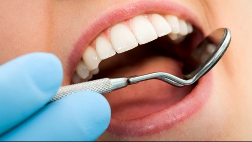 'Para proteger a la población': Diputados plantean prohibir las amalgamas dentales por contener mercurio