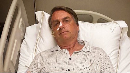 Jair Bolsonaro supera la obstrucción intestinal y médicos descartan que sea sometido a una cirugía