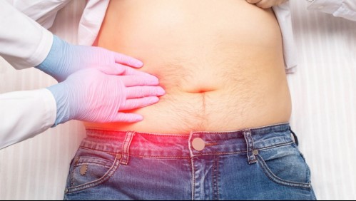 Vesícula inflamada: Así es como se siente tener colecistitis