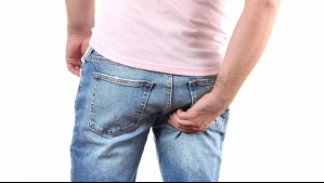 ¿Te pica el trasero?: Estas son 3 razones médicas que podrían explicar tu comezón