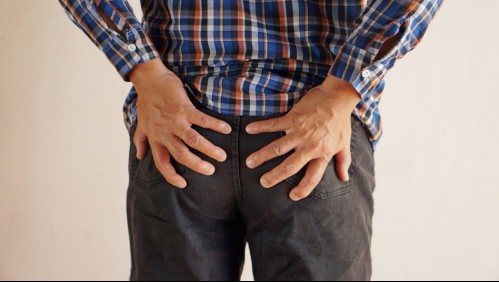 Así es como puedes identificar si es que tus glúteos tienen 'amnesia'