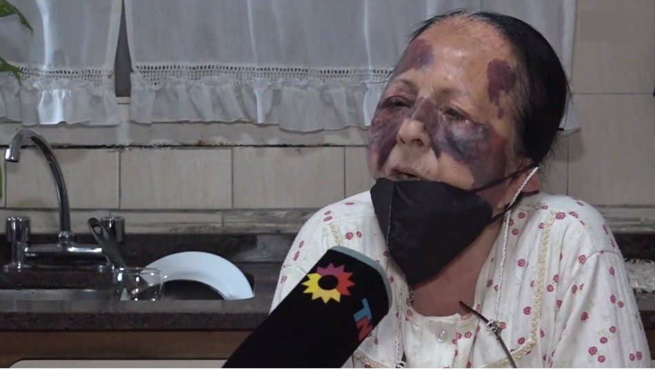 Mujer de 71 años es violentamente agredida por asaltantes en su hogar: Mujer de 71 años es violentamente agredida por asaltantes en su hogar: