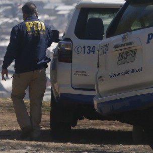 Investigan el caso de una mujer que recibió un balazo en la cabeza y no se dio cuenta Investigan el caso de una mujer que recibió un balazo en la cabeza y no se dio cuenta