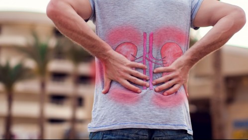 ¿Cuáles son los hábitos que podrían estar dañando a tus riñones?