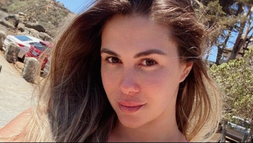 Hiperlordosis: La condición por la que Laura Prieto se sometió a tratamiento médico