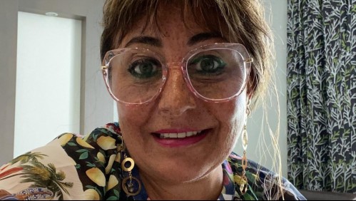 Los médicos no quieren operarla: Esta es la razón por la que Helhue Sukni no se ha podido hacer cirugías estéticas