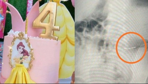 Cumpleaños de una niña termina en una pesadilla: hermanitas comen metal que estaba en el pastel