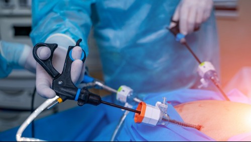 Operaciones para combatir obesidad tendrán pago fijo en Fonasa: ¿En qué consisten las cirugías bariátricas?