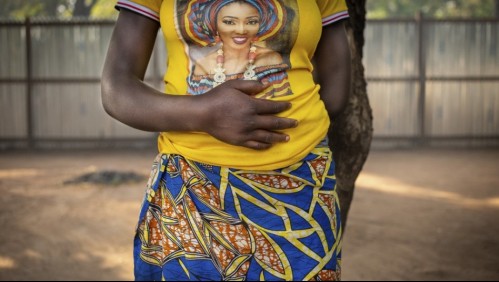 Embarazada llega al hospital con un clavo en su cabeza que un curandero le clavó como garantía para tener un niño