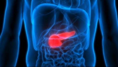 Estos son los ocho síntomas que podrían indicar que tienes cáncer de páncreas