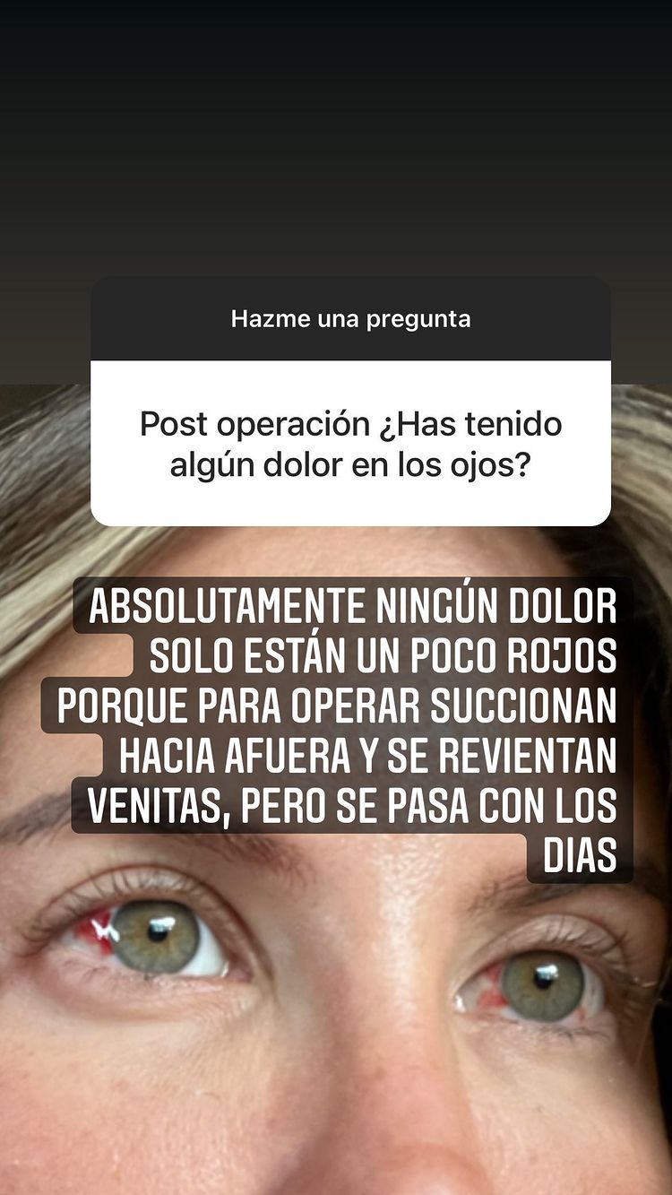 Historia de Instagram de Coté López