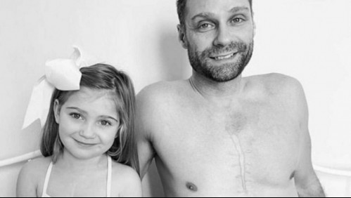 El emotivo gesto de un padre con su hija de 4 años: Se tatuó la cicatriz que ella tiene en el pecho