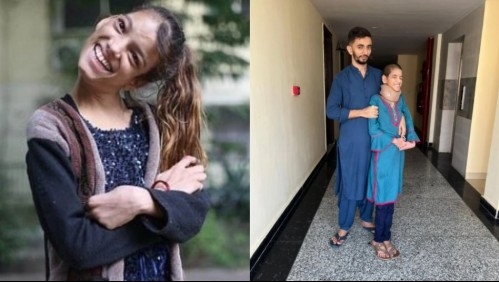 La historia de la joven que pasó 13 años con la cabeza torcida en un ángulo de 90 grados