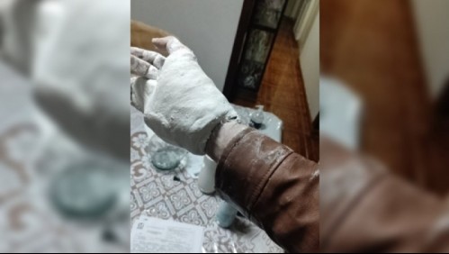 Joven acude al seguro para que le pongan un yeso en su brazo y ahora no puede quitarse la chaqueta