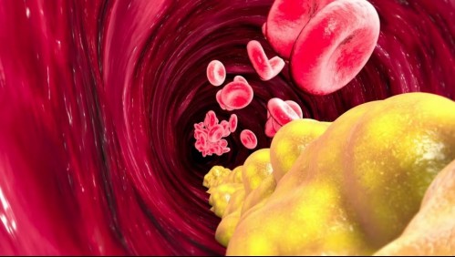 Esta es la mejor forma para saber si es que tienes el colesterol alto