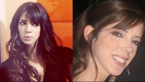 Muere reconocida periodista venezolana que padecía esclerosis múltiple: ¿En qué consiste la enfermedad?