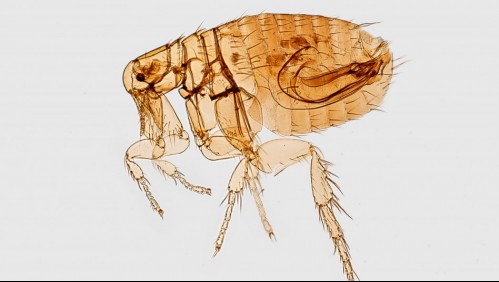 Estos son los 8 síntomas con los que se presenta el tifus