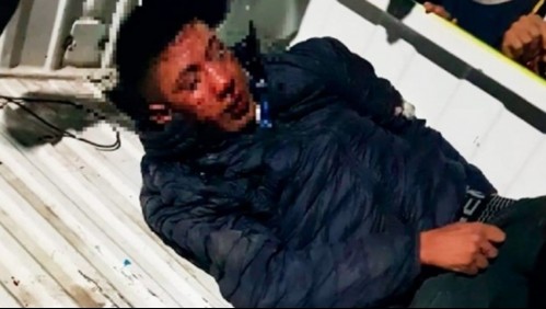 'Estamos cansados': vecinos detienen a un presunto motochorro y le amputan dos dedos de una mano