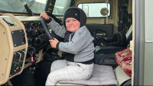 Hasbulla Magomedov: Este es el trastorno genético que tiene el joven ruso que causa furor en redes sociales