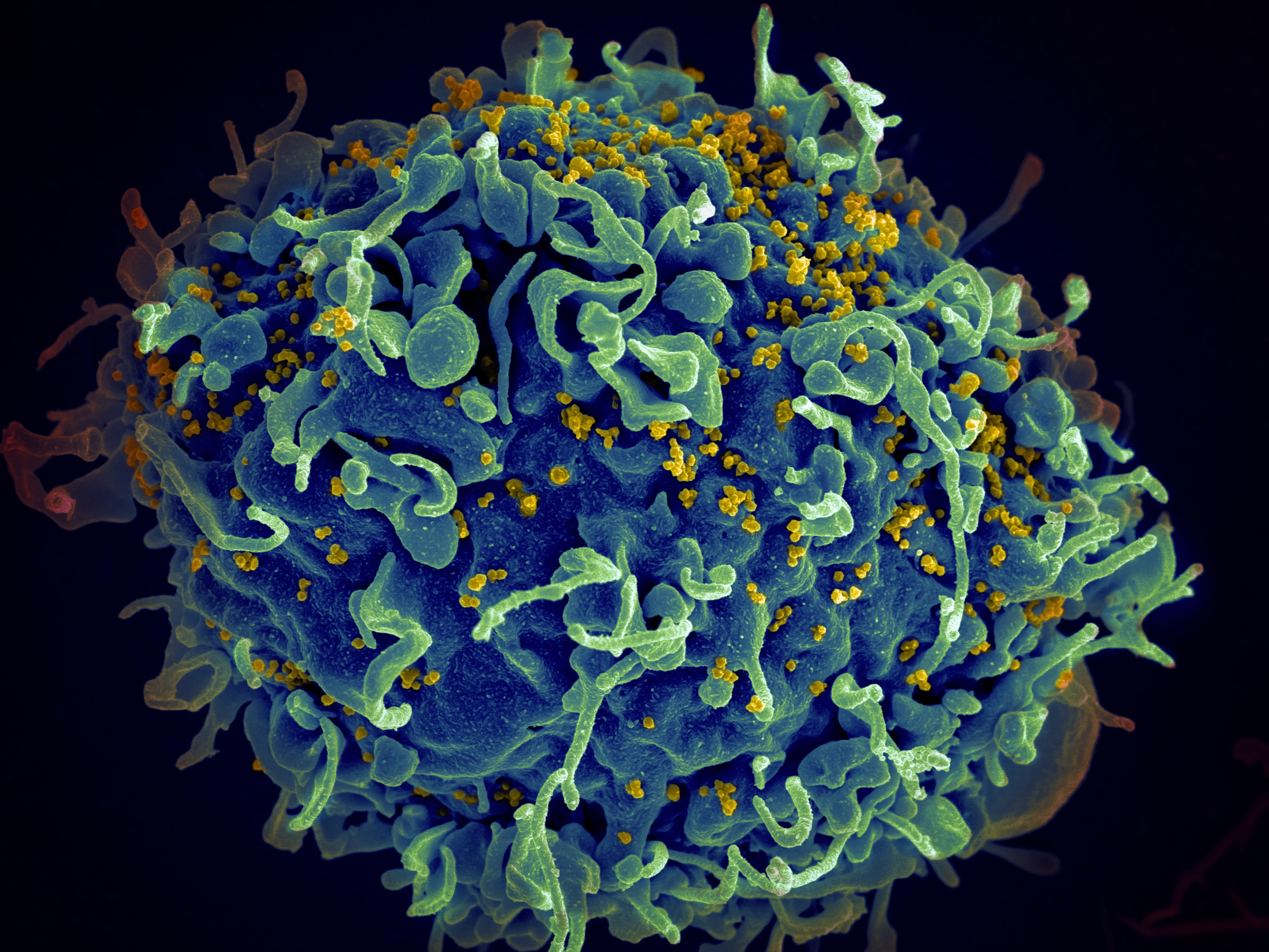 Ilustración virus VIH