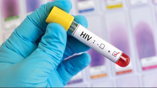 Científicos chilenos lograron detener multiplicación viral del VIH: Abre opción a nuevos tratamientos