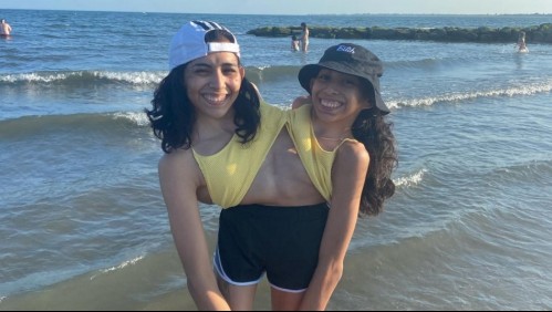 Siamesas onfalópagos: Este es el caso de Lupita y Carmen, las hermanas que no pueden ser separadas