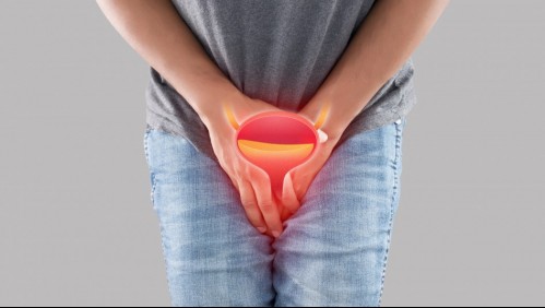 Uretritis: ¿Cuáles son los síntomas de esta infección?