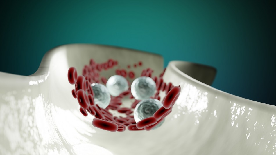 arterias arterias
