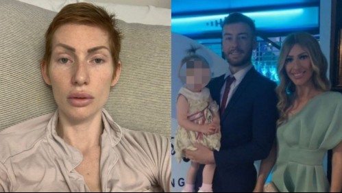 Fue al médico quejándose por un dolor abdominal y terminó recibiendo un diagnóstico que le provocó la muerte