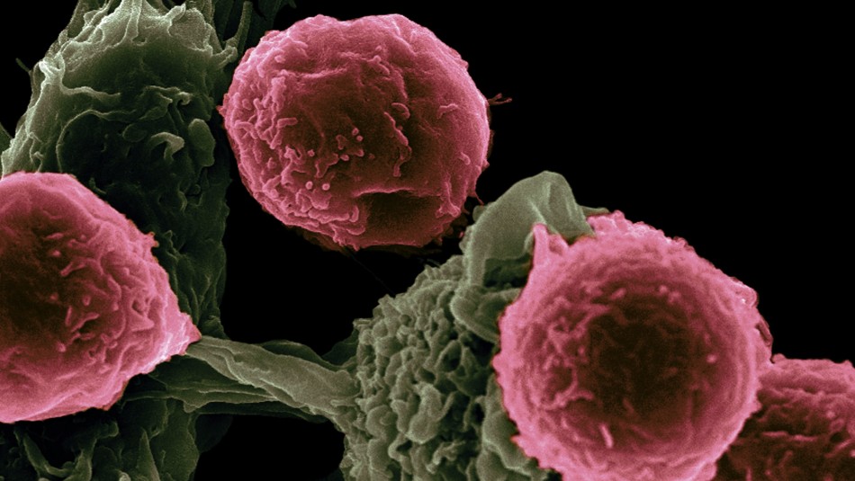 Gran avance científico: Desarrollan fármaco que detiene el crecimiento y metástasis de cáncer Gran avance científico: Desarrollan fármaco que detiene el crecimiento y metástasis de cáncer