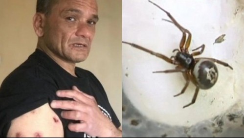 'Yo era un banquete': La aterradora historia de un hombre mordido por cientos de arañas que invadieron su casa