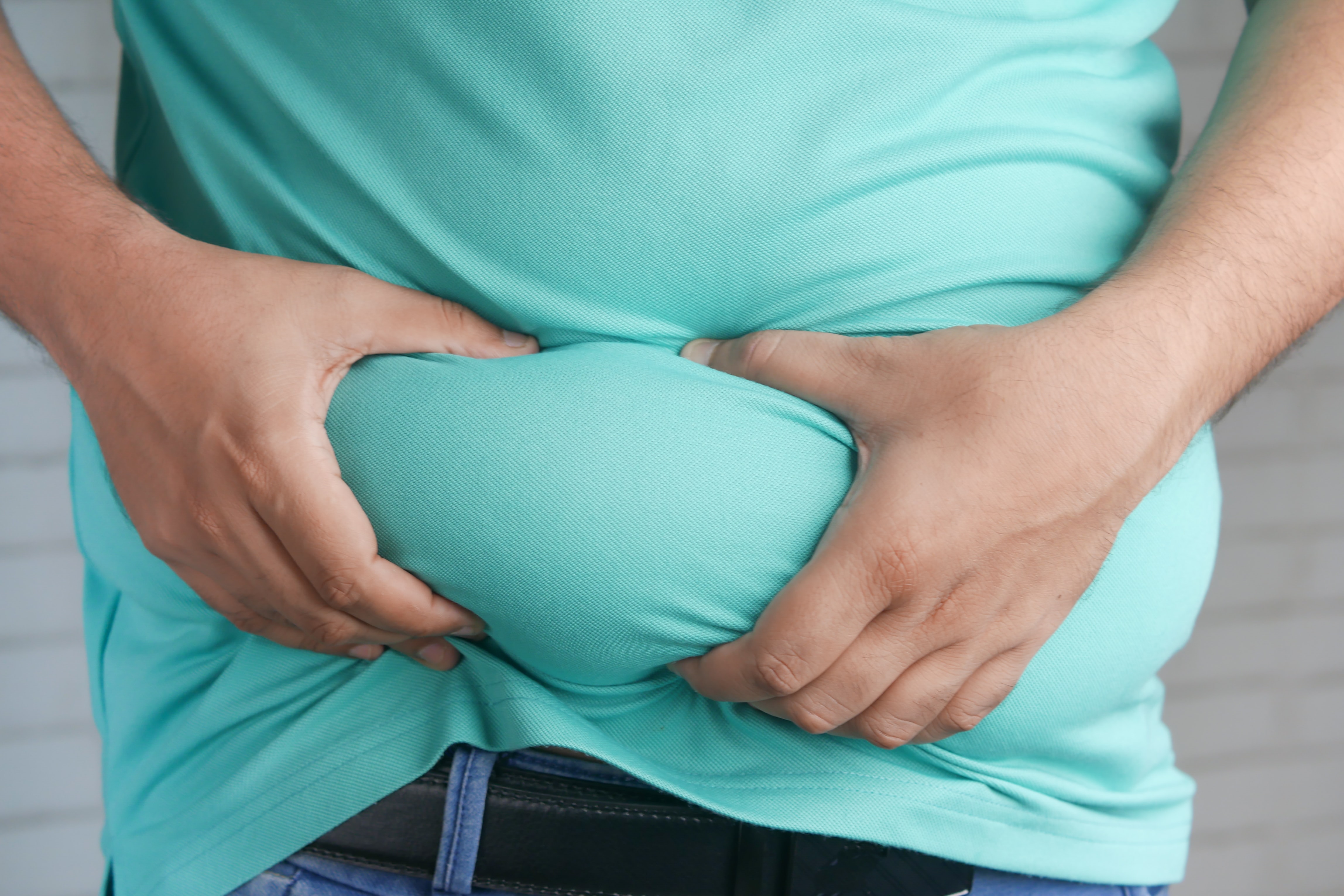 Persona sosteniendo exceso de grasa de su abdomen