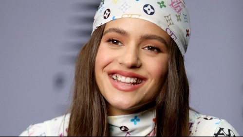 Joyas en los dientes: Estos son los riesgos del icónico accesorio que usa Rosalía