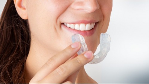 Bruxismo: Las 9 señales que te ayudarán a reconocerlo