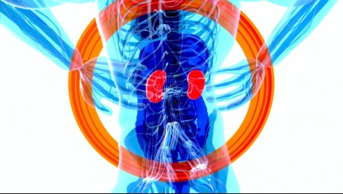 Enfermedad en los riñones: 14 síntomas que te permiten conocer si tus órganos no están funcionando de forma correcta
