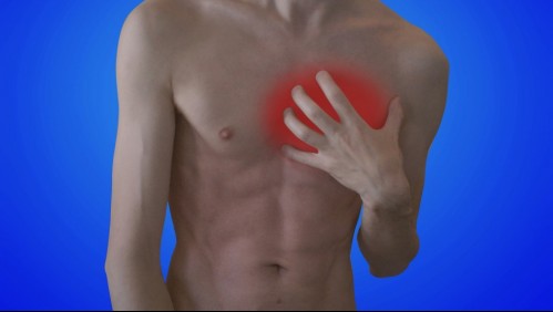 Angina de pecho: Estas son algunas de las razones por las que podrías sentir el preocupante dolor