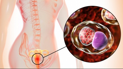 Clamidiasis: Estos son los síntomas de la enfermedad de transmisión sexual más frecuente en el mundo