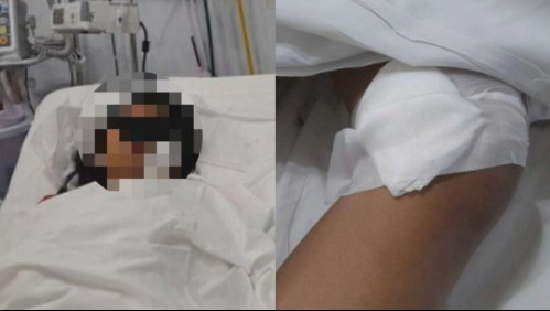 'Mamá, me muero': El dramático pedido de auxilio de niña de 13 años que apuñalaron para robarle el celular