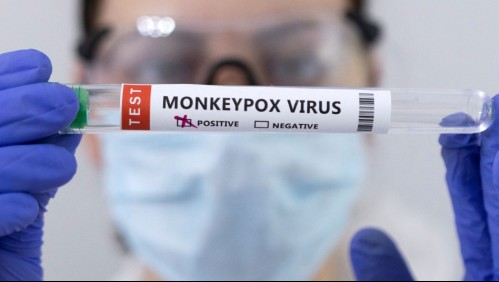 Experto de la Universidad de Ginebra: 'Nada indica que el virus de la viruela del mono se transmite por vía sexual'
