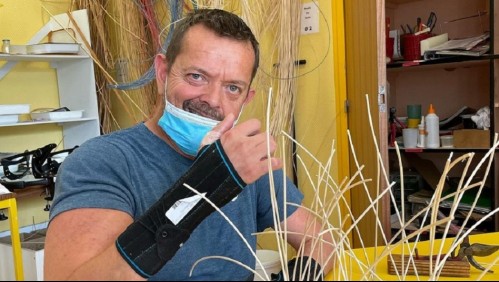 Puede manejar y lavarse los dientes: Esta es la exitosa historia del primer doble trasplante de brazos del mundo