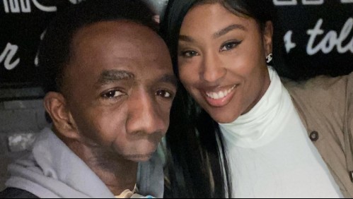 La historia del hombre que nació sin mandíbula y que encontró el amor tras luchar toda su vida con la inseguridad