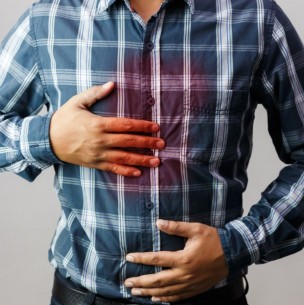 ¿Sufres de reflujo? Estos son los síntomas de la enfermedad que podrías padecer ¿Sufres de reflujo? Estos son los síntomas de la enfermedad que podrías padecer