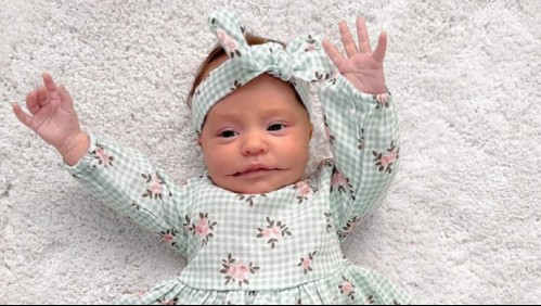 'Síndrome de la sonrisa permanente': La historia de la bebé que nació con extraña malformación que afecta a su boca