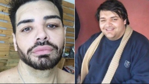 Exchico reality se hizo más de 20 operaciones para parecerse a Ricky Martin: 'Quedé más lindo que él'